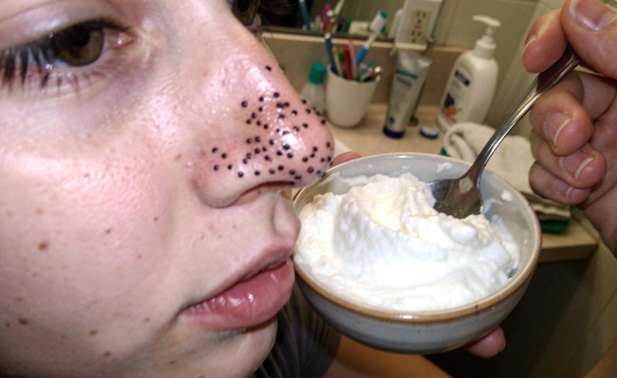 Erase Blackheads Forever with This Surprising Household Staple: How It Clears Pores in Just One Use